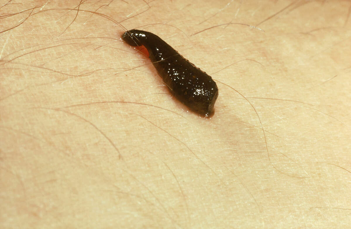 Leeches are most active are hot days. 