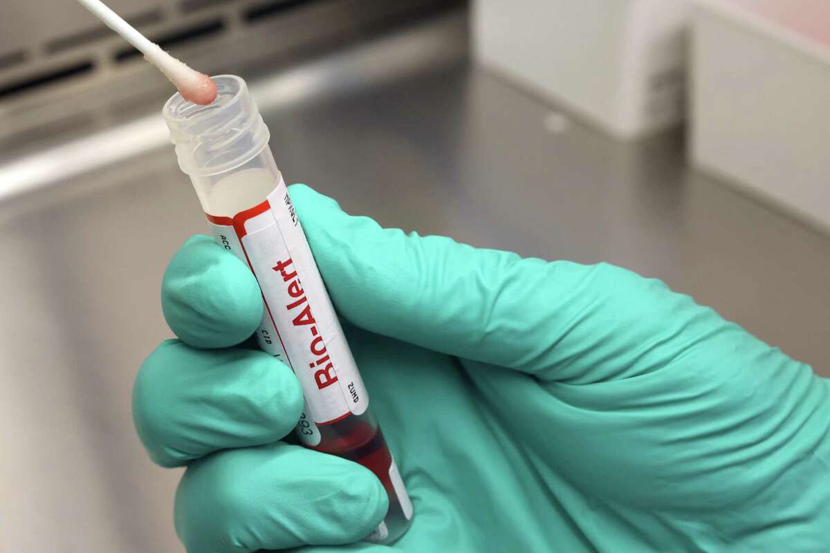 A swab that tested positive for the Monkeypox virus is seen at the UW Medicine Virology Laboratory at the UW Medicine Virology Laboratory on July 12, 2022 in Seattle, Washington. (Photo by Karen Ducey/Getty Images)