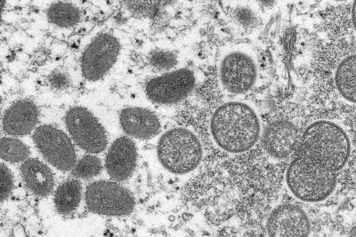 FILE - This 2003 electron microscope image made available by the Centers for Disease Control and Prevention shows mature, oval-shaped monkeypox virions, left, and spherical immature virions, right, obtained from a sample of human skin associated with the 2003 prairie dog outbreak.