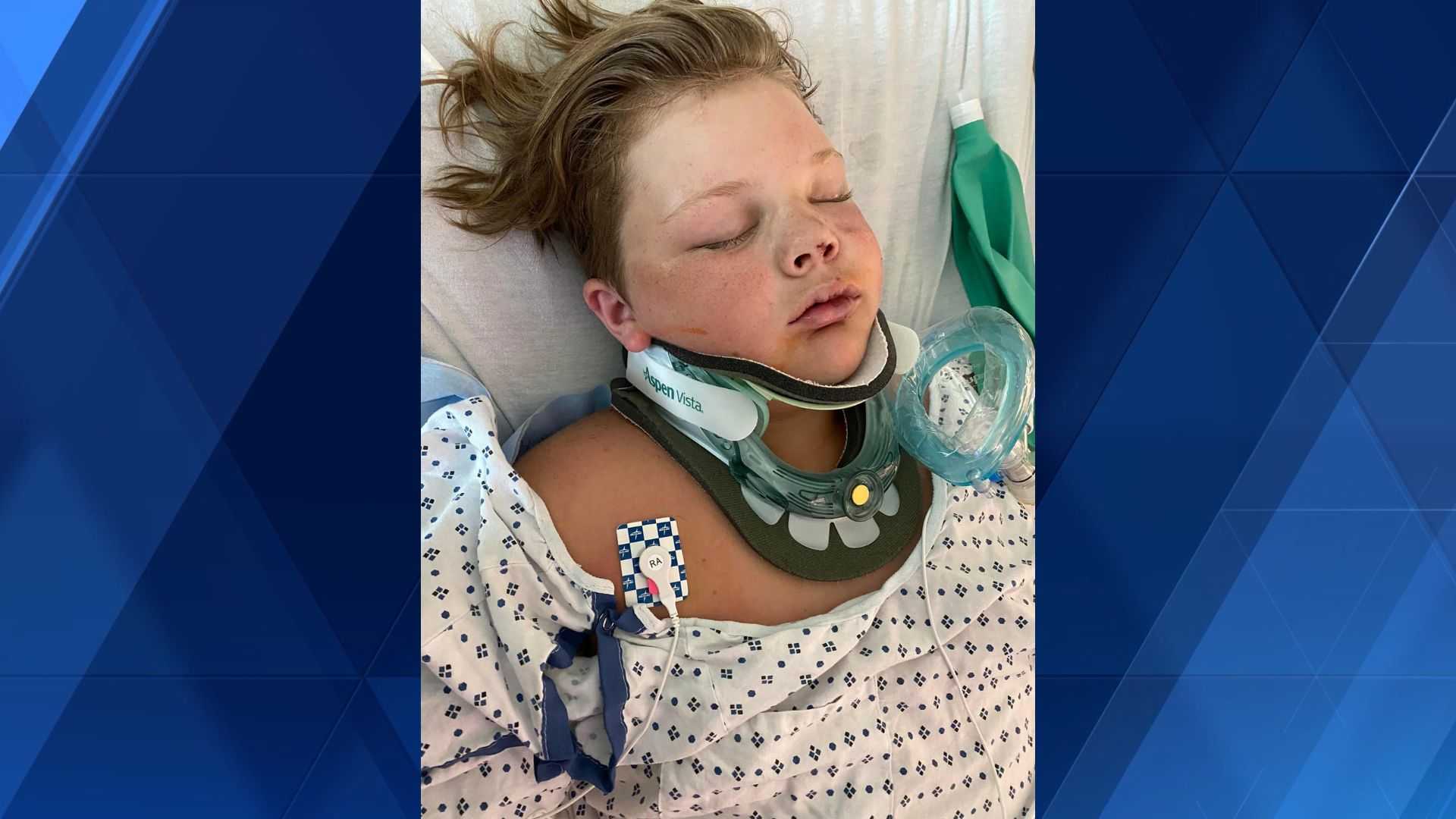 Ohio teen recovering after tree falls on top of him at birthday party