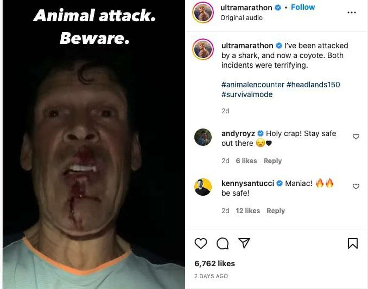 Dean Karnazes documenting his attack by a coyote that happened while he was running near the Golden Gate Bridge in an ultramarathon.