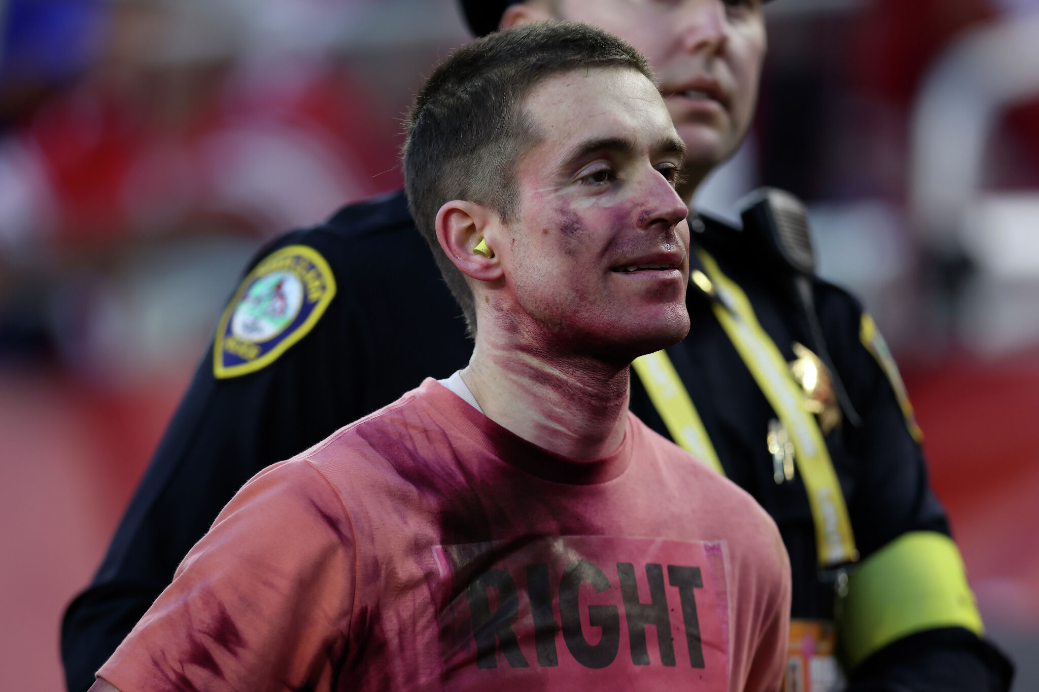 Protester from notorious group bloodied by Rams LB after running