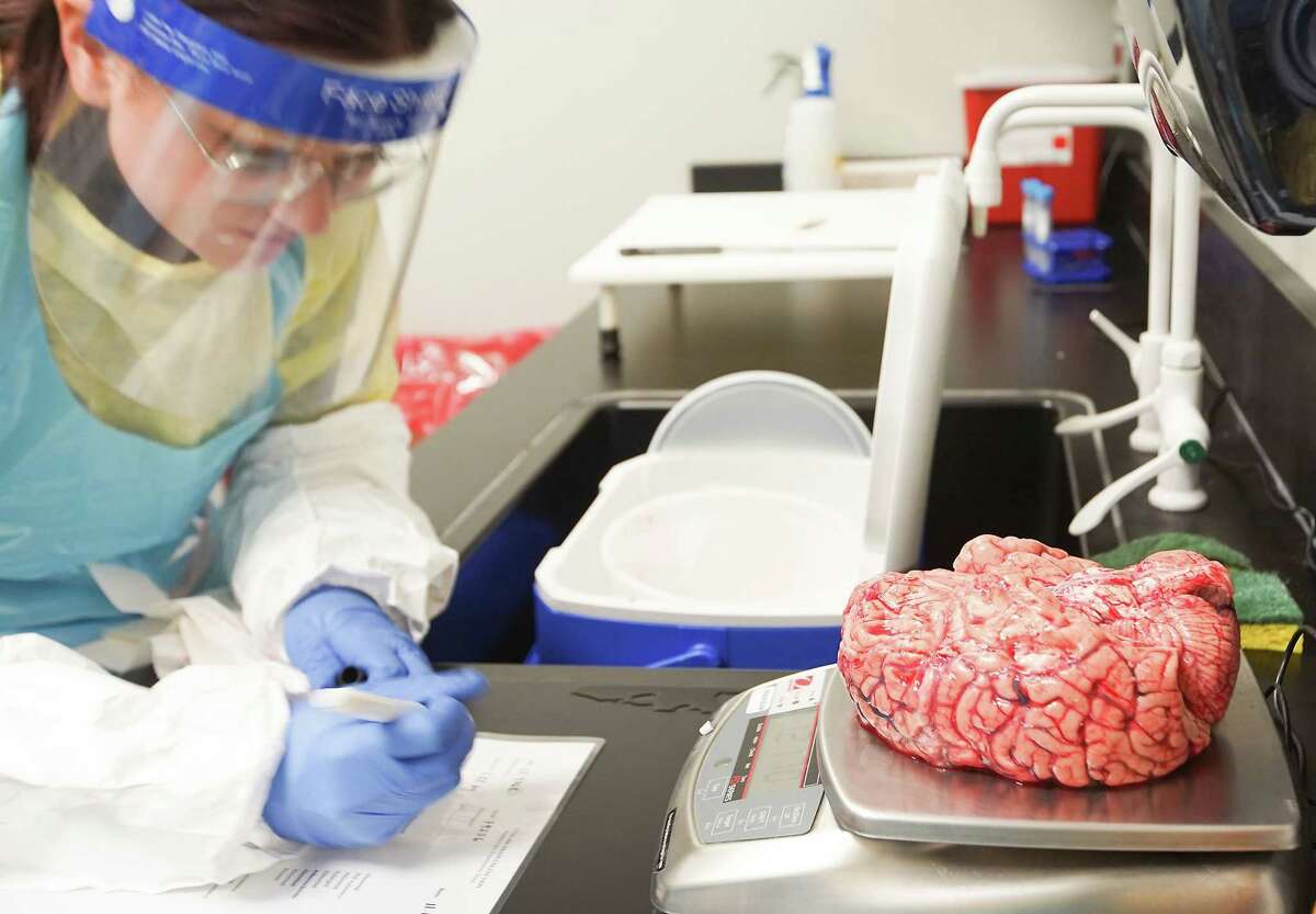 Alana Bradley, research assistant at UTHealth Science Center, weighs a brain for the UTHealth Brain Collection on Wednesday, Nov. 16, 2022, in Houston.