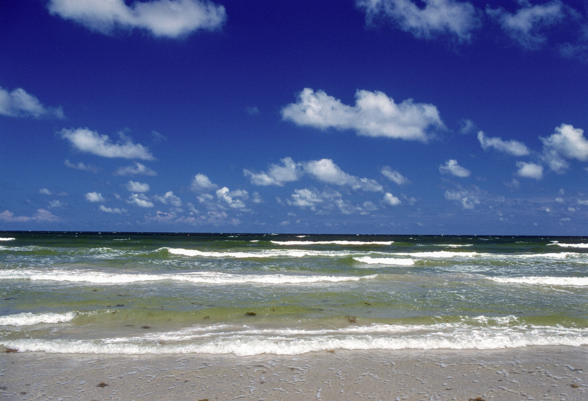 Texas Surfers Share Shark Bite Experience At Corpus Christi Beach