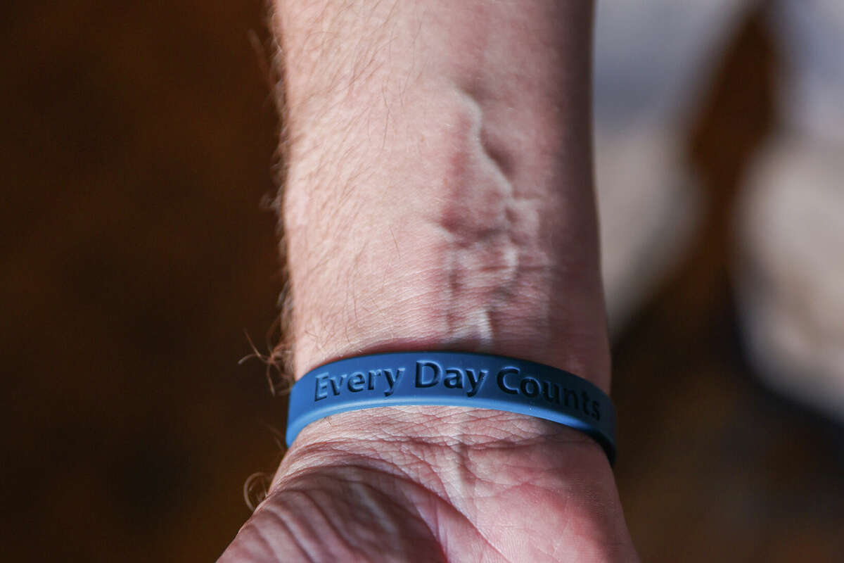 Ben Campofreda, a recovering fentanyl addict, shows off his bracelet reading â Every Day Countsâ while in his room in rehab at Walden House in San Francisco, Calif., on Saturday, Nov. 6, 2022. He is recovering from multiple surgeries while getting drug treatment.