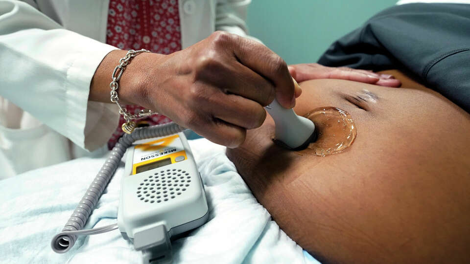 FILE - A doctor uses a hand-held Doppler probe on a pregnant woman to measure the heartbeat of the fetus on a patient. COVID-19 drove a dramatic increase in the number of women who died from pregnancy or childbirth complications in the U.S. last year, a crisis that has disproportionately claimed Black and Hispanic women as victims, according to a report released Wednesday, Oct. 19, 2022. (AP Photo/Rogelio V. Solis, File)