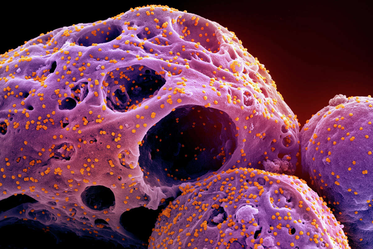 An electron microscope image of cells infected with the omicron strain of SARS-CoV-2, shown in orange.