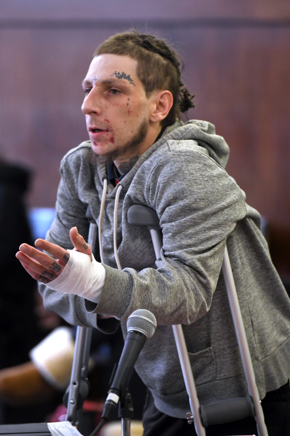 Unarmed man shot at by CT police claims foot broken during arrest