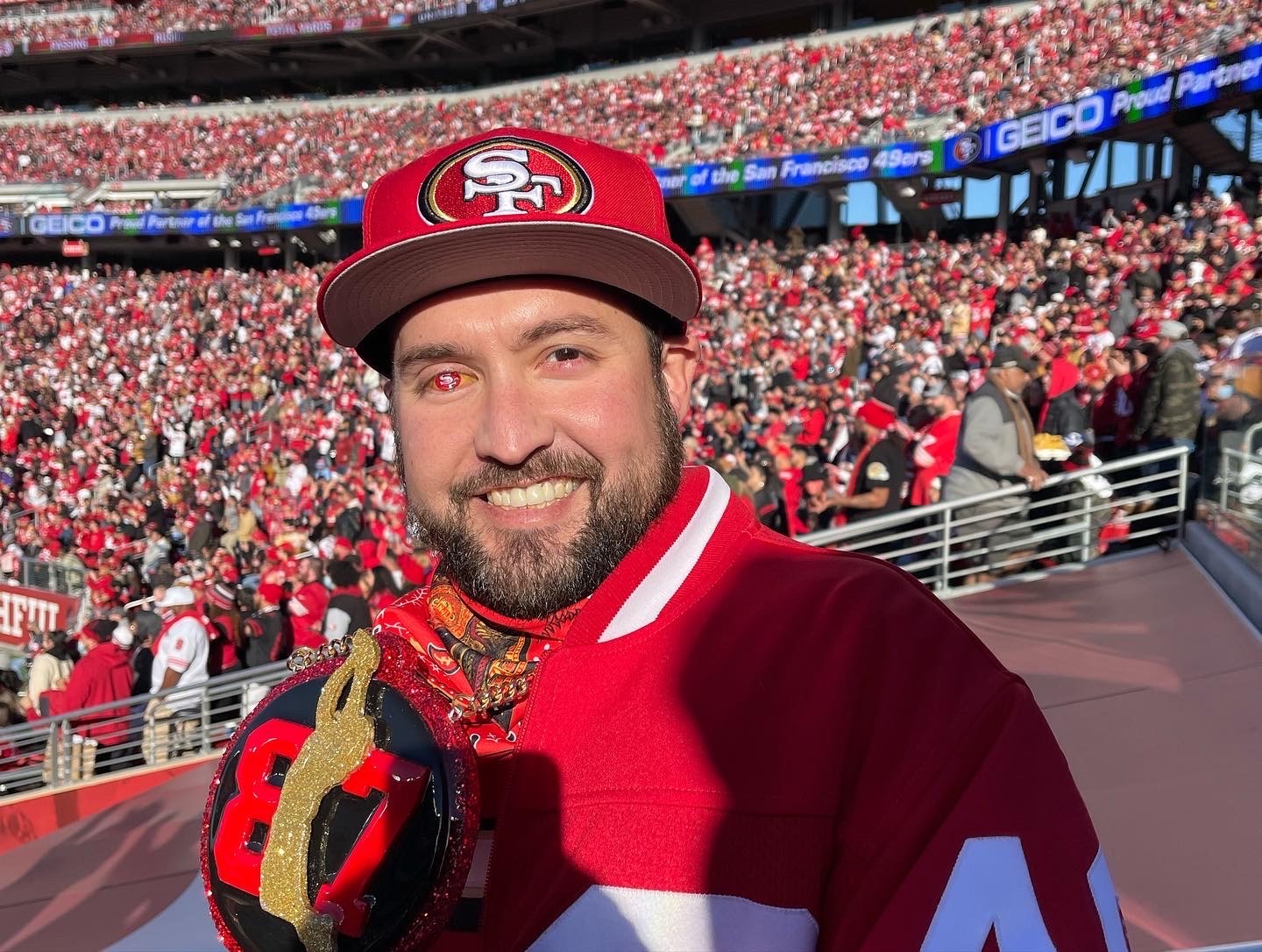 This 49ers superfan has a prosthetic eye with the team logo