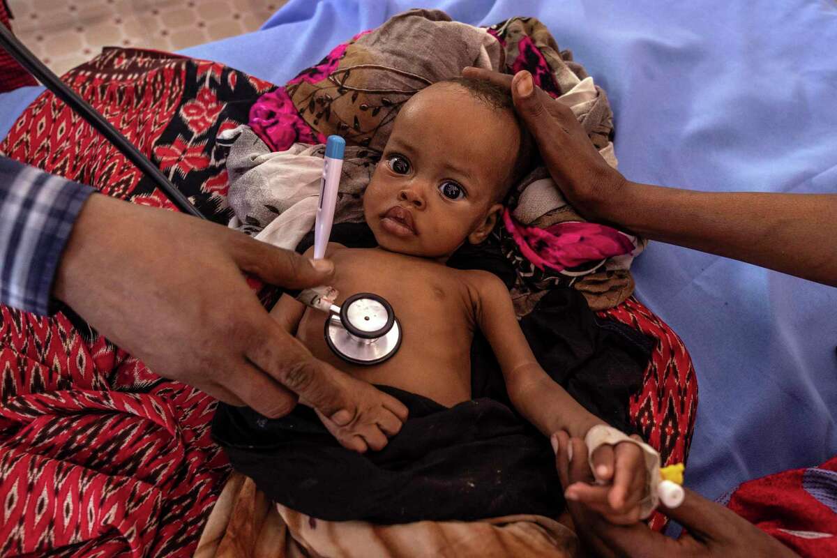 A doctor monitors a malnourished baby in Doolow, Somalia, on Jan. 10. In this age of miracles, it is possible to feed the hungry and push away death — and do it remarkably cheaply.