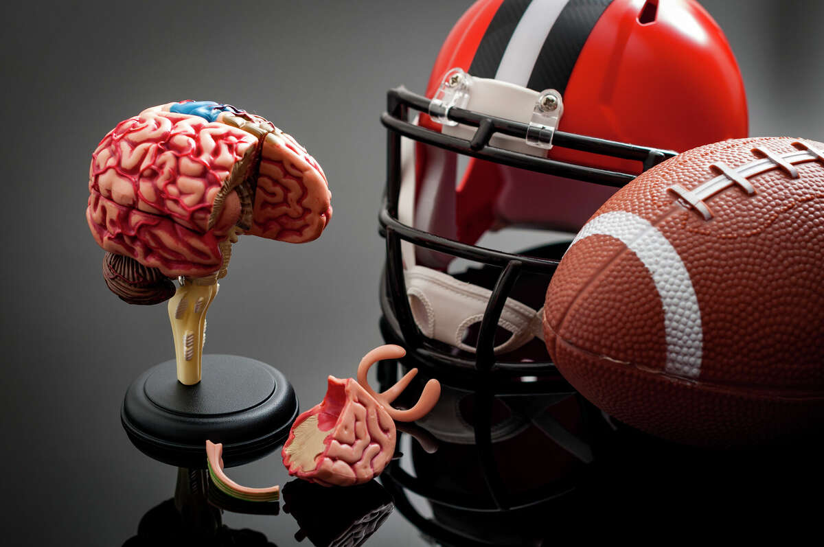 Brain damage and sports injury concept with damaged brain model, american football helmet and a ball, illustrating CTE (Chronic traumatic encephalopathy) a syndrome caused by repeated concussion
