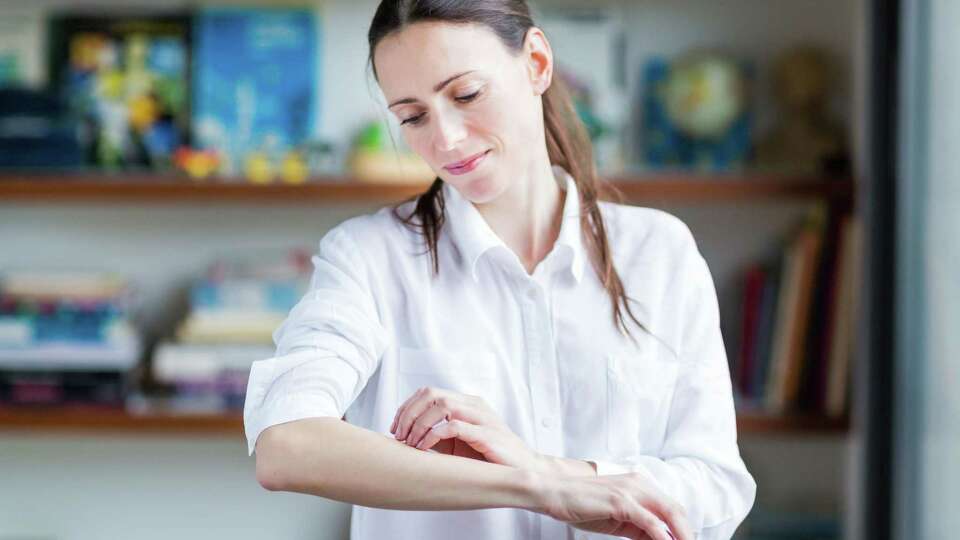 Woman itching her arm.