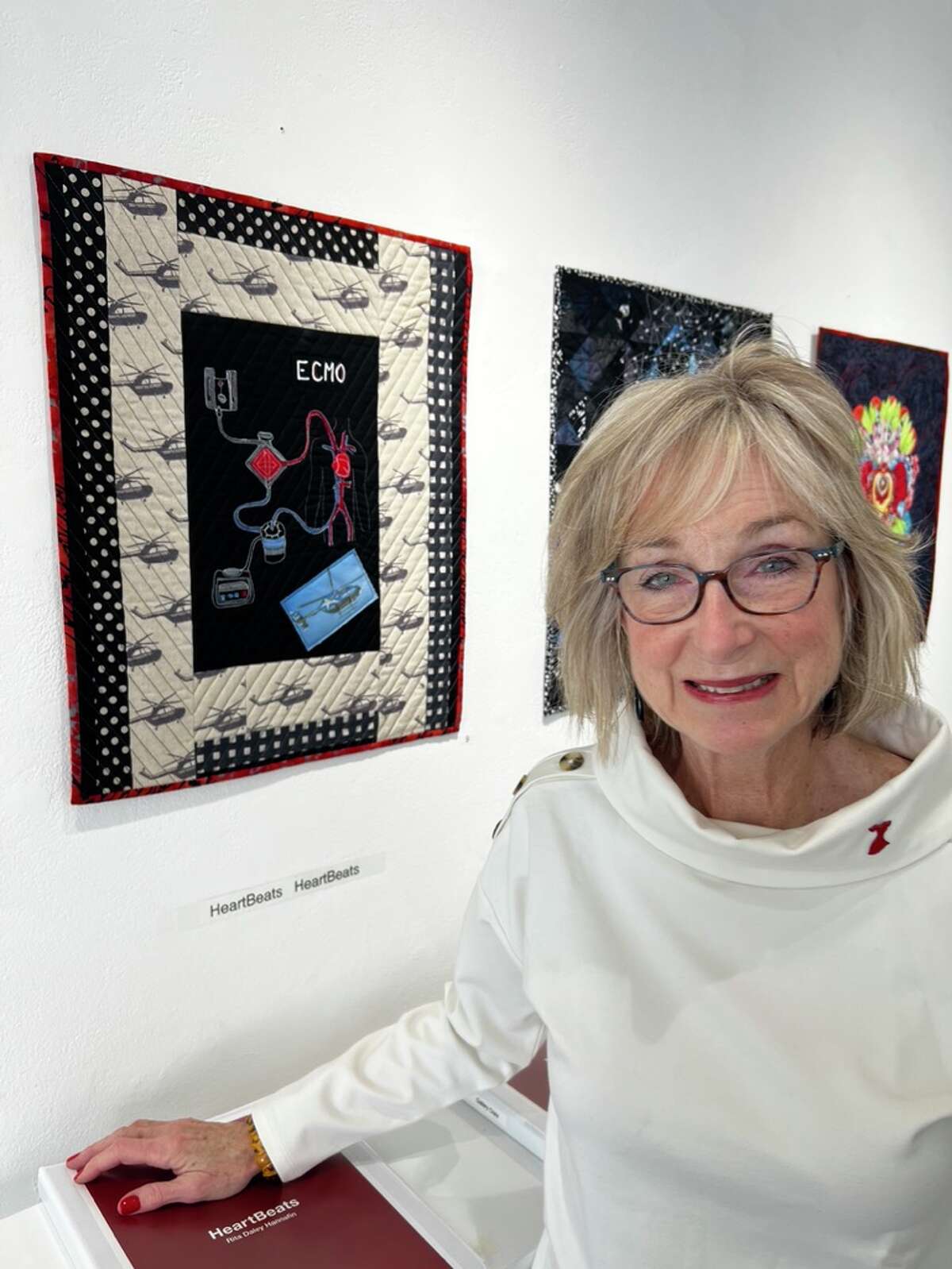 Rita Hannafin is an artist and has turned her experience into art, both to process it herself and share it with others. She just completed an opening at City Gallery in New Haven, part of which was a five-piece series called “HeartBeats.”