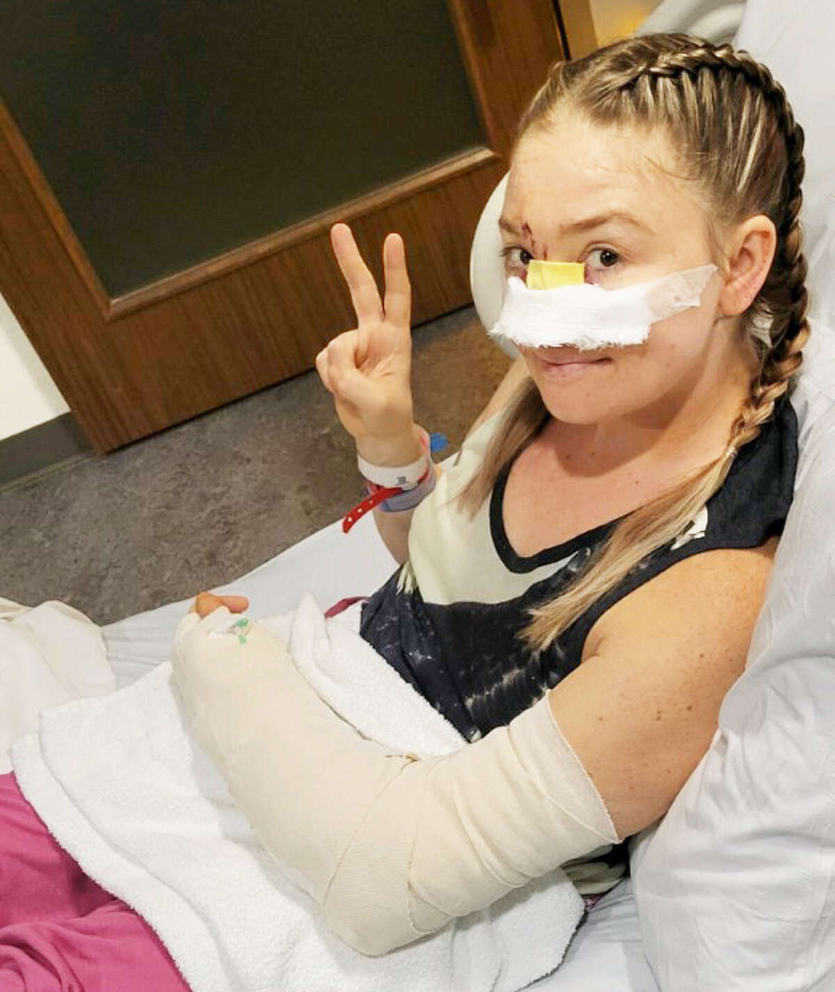 Olivia Quast, 30, formerly of Middletown, was attacked by her rescue dog Feb. 3, leaving her with a "mangled" arm and severe damage to her face. A GoFundMe has been set up to help pay for medical bills associated with plastic surgery to replace her nose.