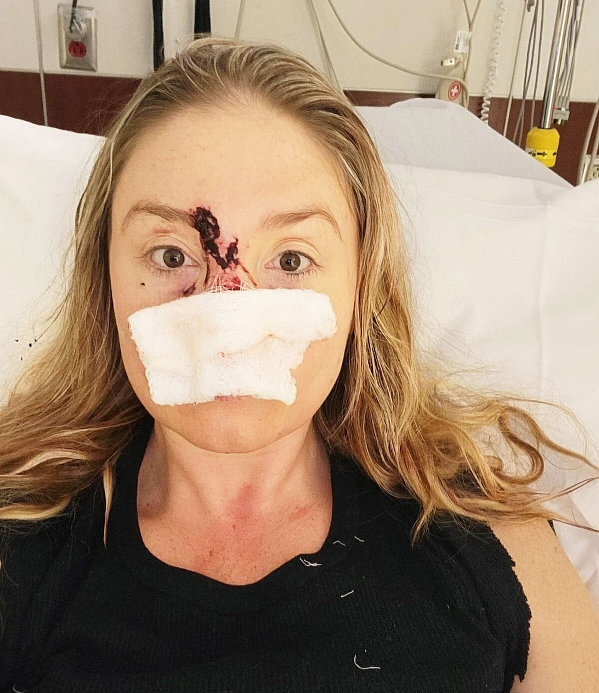 Olivia Quast, 30, formerly of Middletown was attacked by her rescue dog Feb. 3, leaving her with a "mangled" arm and severe damage to her face. A GoFundMe has been set up to help pay for medical bills associated with plastic surgery to replace her nose.