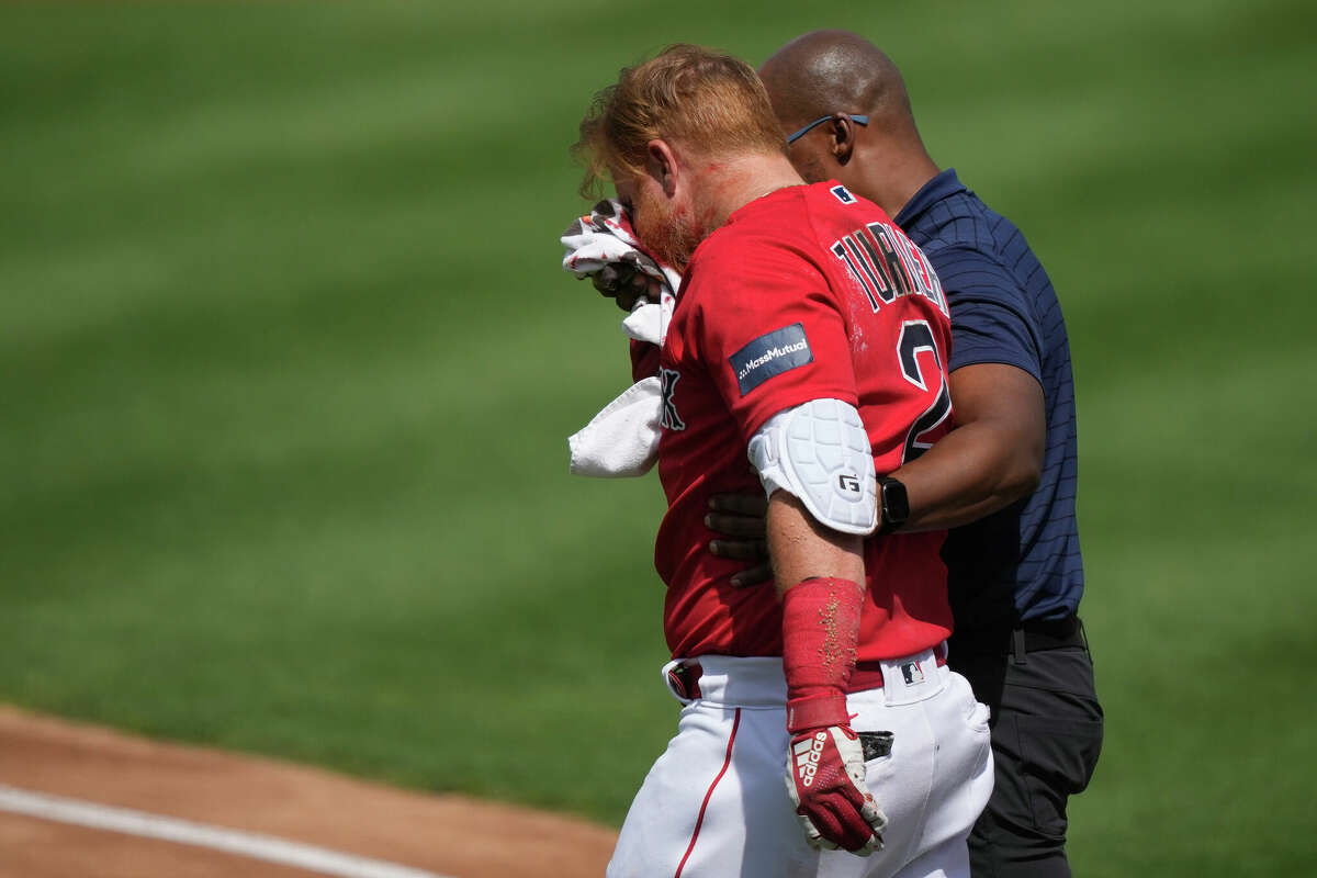 Boston Red Sox Justin Turner is walked off the field after being hit in the face on a pitch by Detroit Tigers starting pitcher Matt Manning in the first inning of their spring training baseball game Monday, March 6, 2023, in Fort Myers.