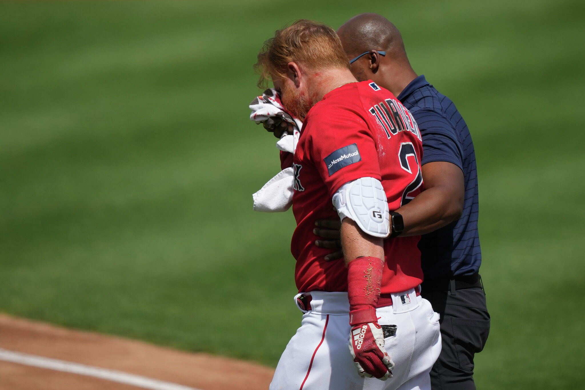 Red Sox Star Justin Turner Needs 16 Stitches In Face After Being Drilled By  Pitch