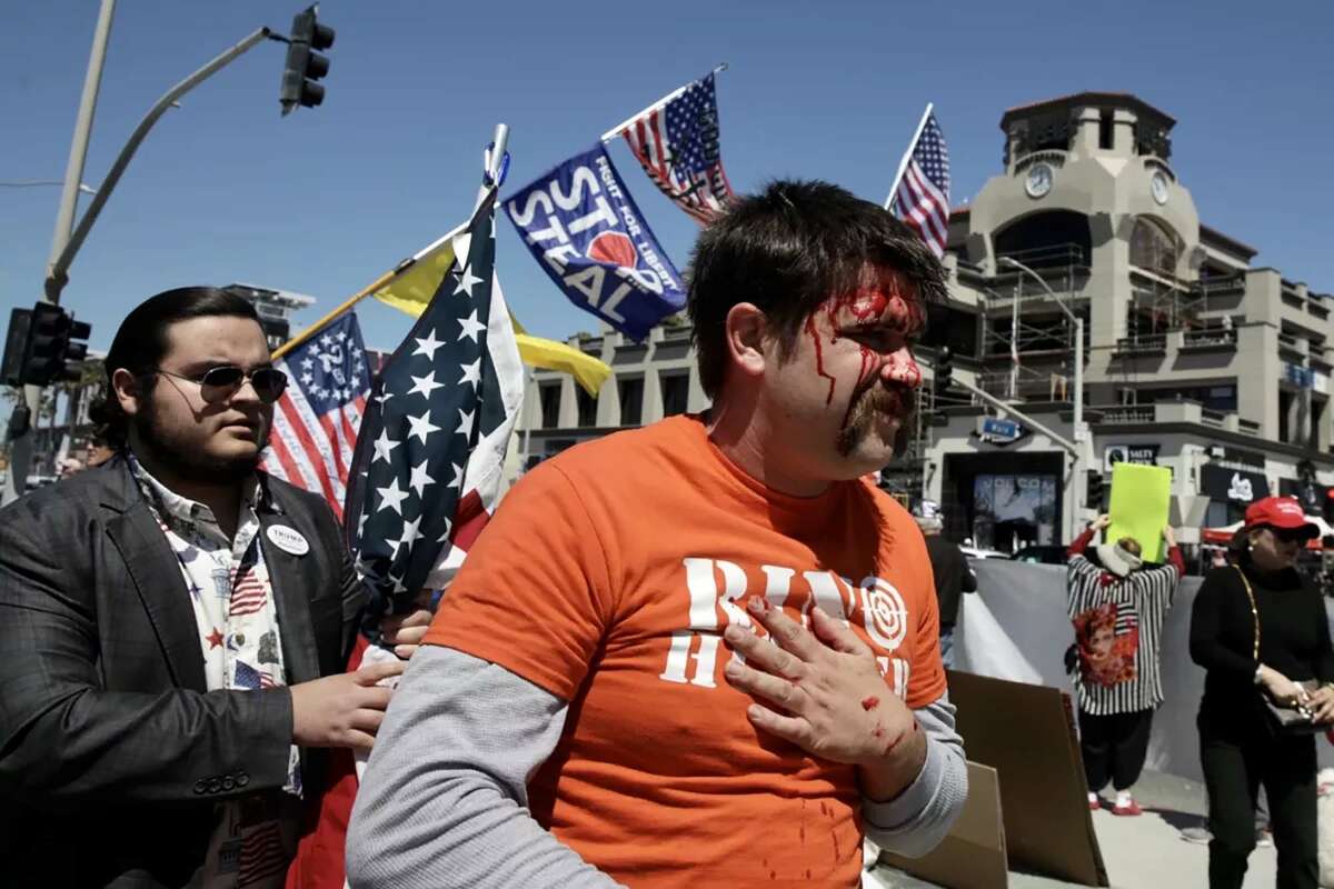 A man was hit in the head with a skateboard during a rally in support of former President Donald Trump on Saturday, April 1, 2023, in Huntington Beach, California.