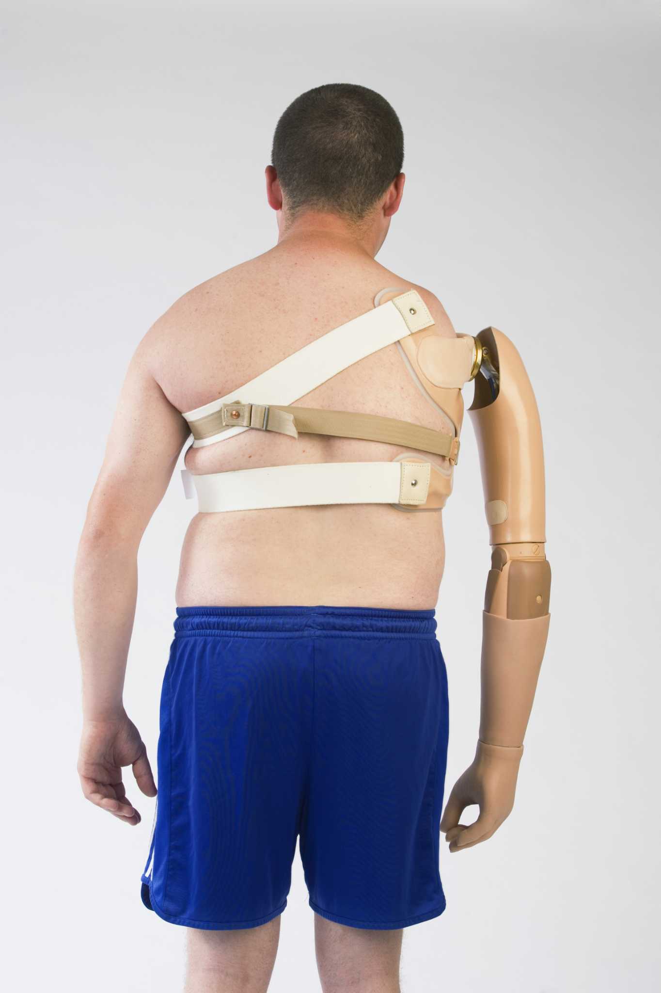 How Do Electronic Prosthetics Work?