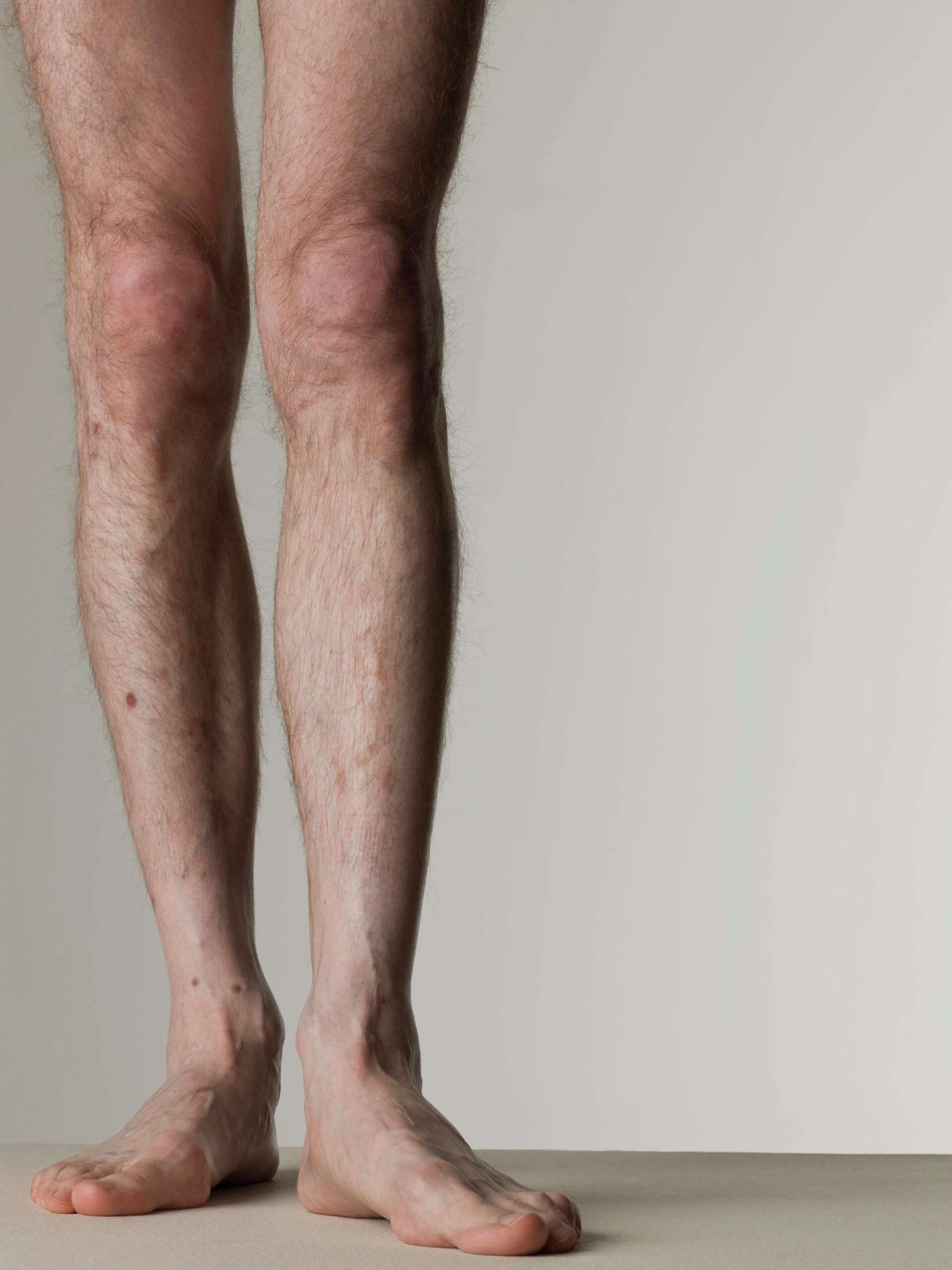How Men Can Lose Leg Fat Quickly