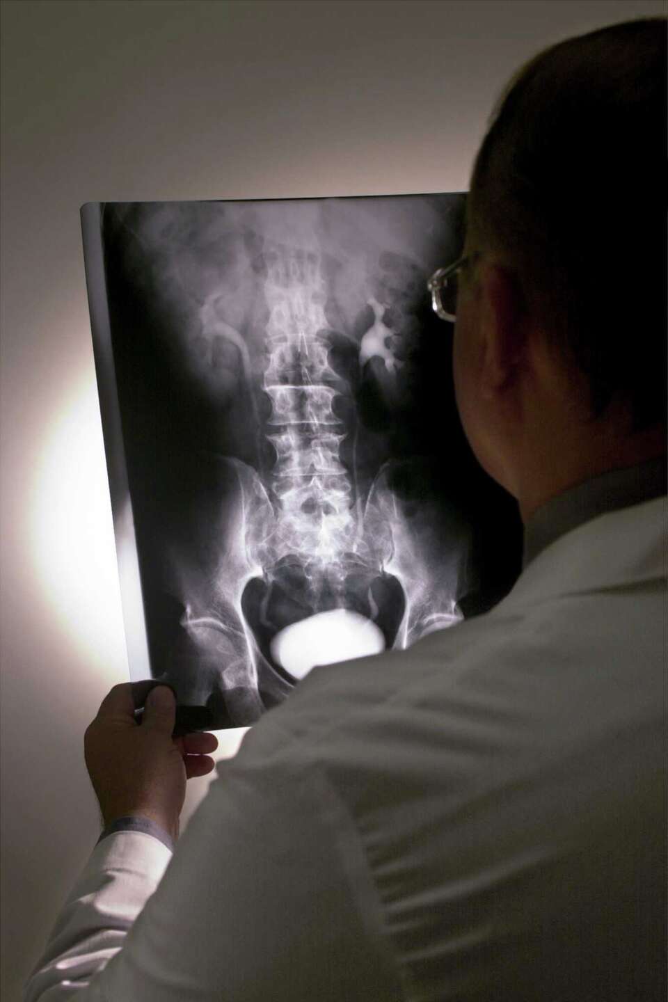 Prostate Cancer and X-rays