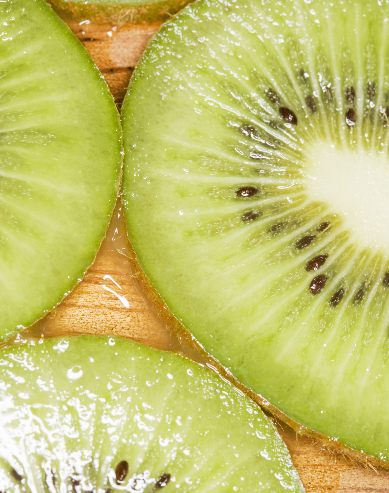 How to Trellis Hardy Kiwi