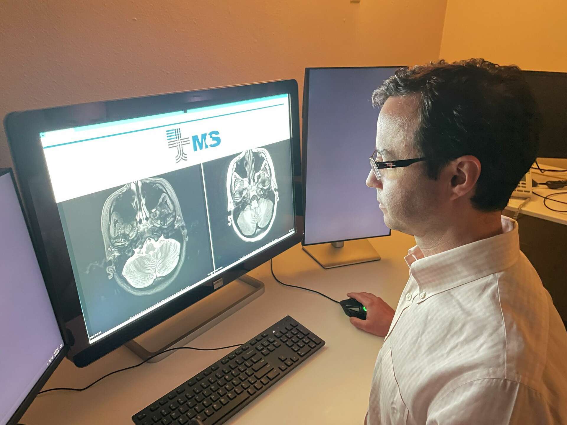 Opinion Ai Could Replace Doctors It S Time To Prepare