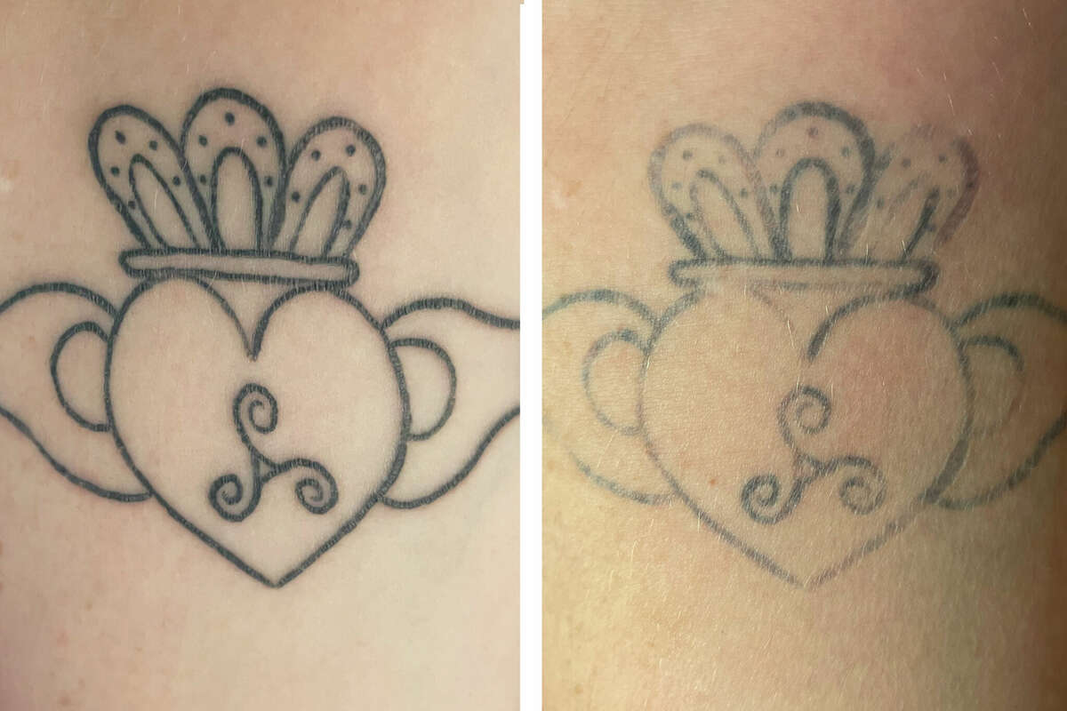 Temporary-tattoo startup Ephemeral closings studios after complaints
