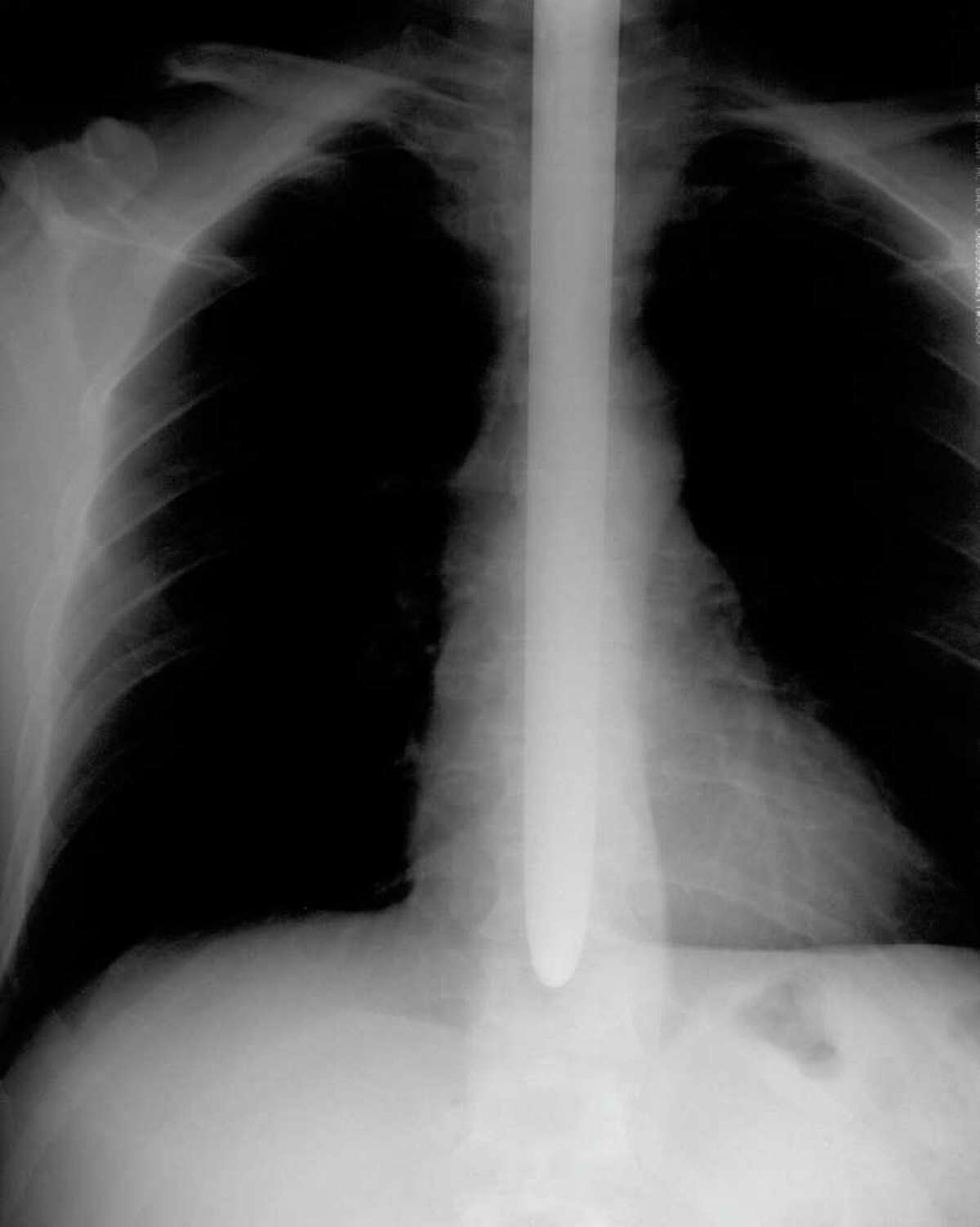 The Sword Swallower Dan Meyer is bringing his peculiar art and nerves