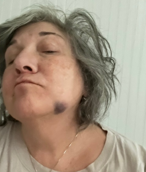Suspect in assault on CT nurse rearrested after skipping court date