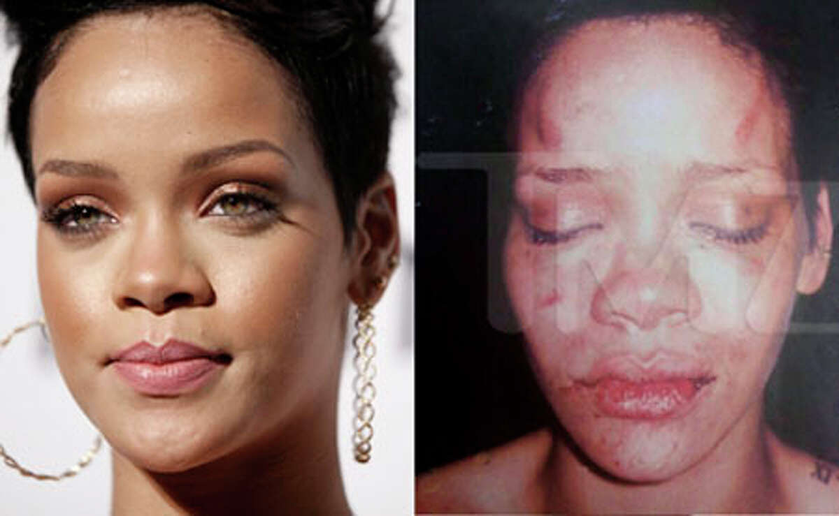 rihanna and chris brown fight pictures tmz