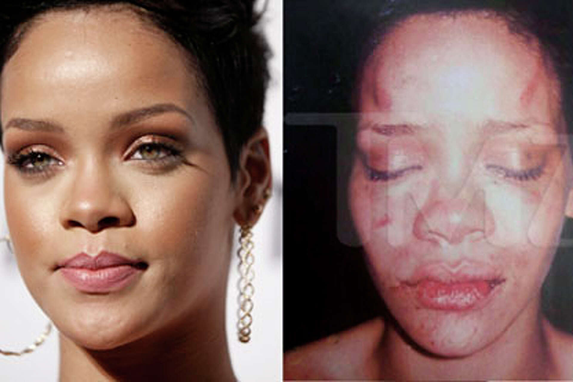 Web site posts photo it claims is a beaten Rihanna