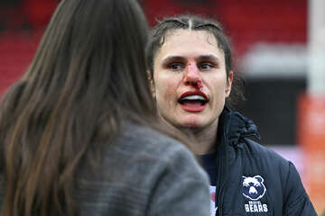 Ilona Maher breaks nose in pro rugby match, shows off on Instagram