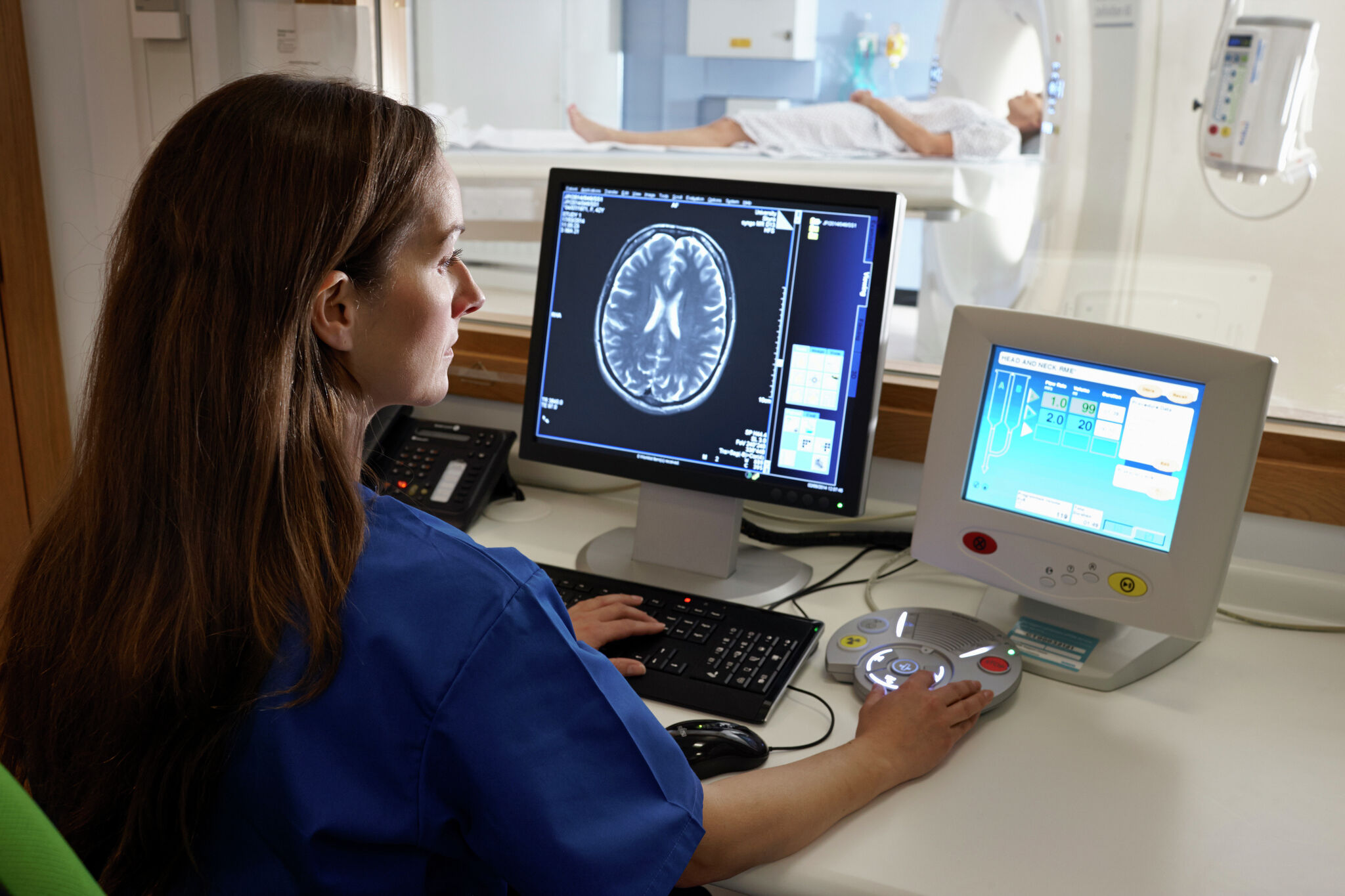 Natoe AI Deploys Automated Pre-Read Reports to Combat Radiologist Shortage