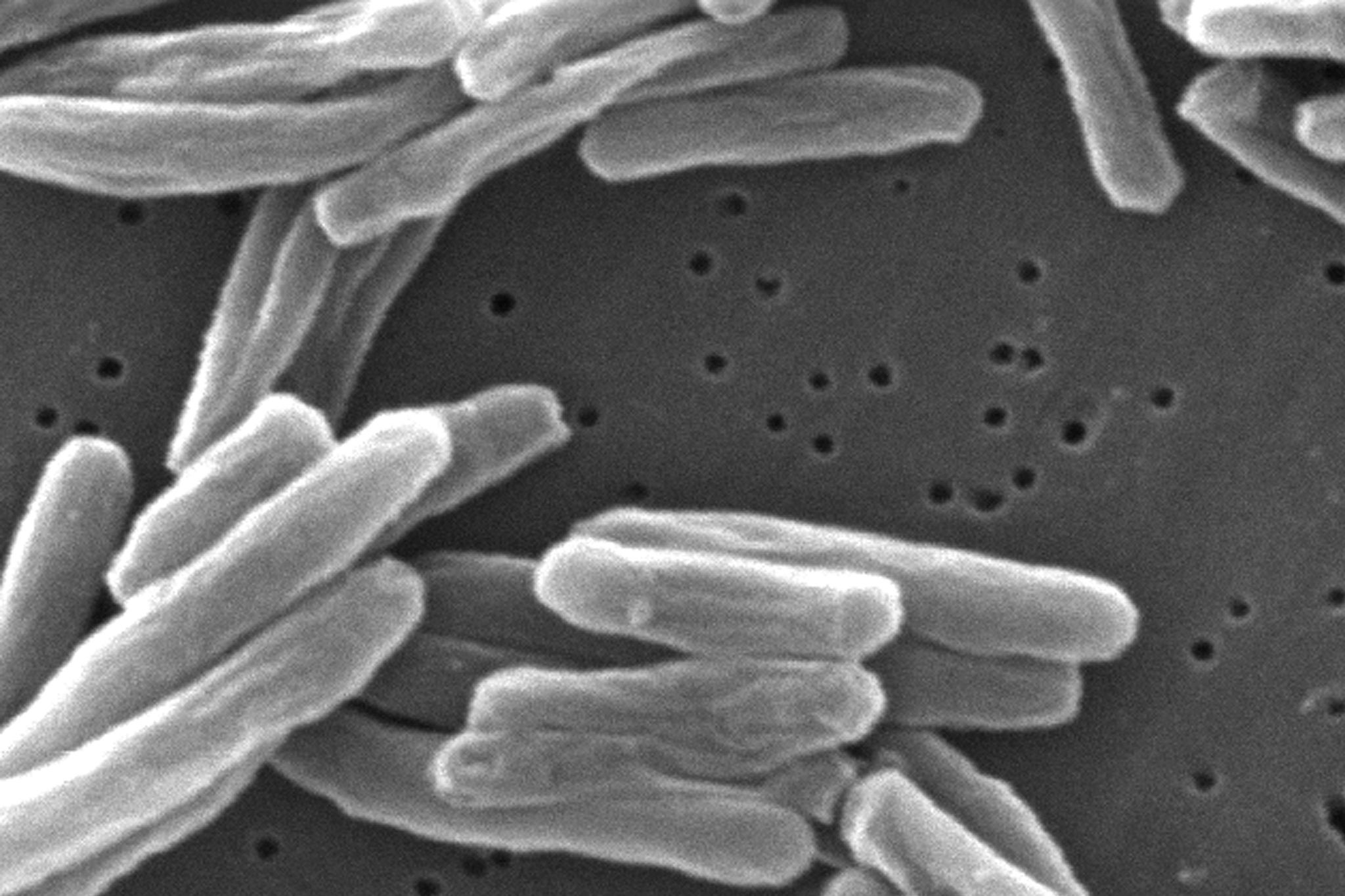 Tuberculosis Cases Surge in the U.S. to Highest Level Since 2011