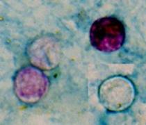 Is your lettuce safe? What H-E-B, Whole Foods say as Cyclospora cases rise in Austin - Austin American-Statesman