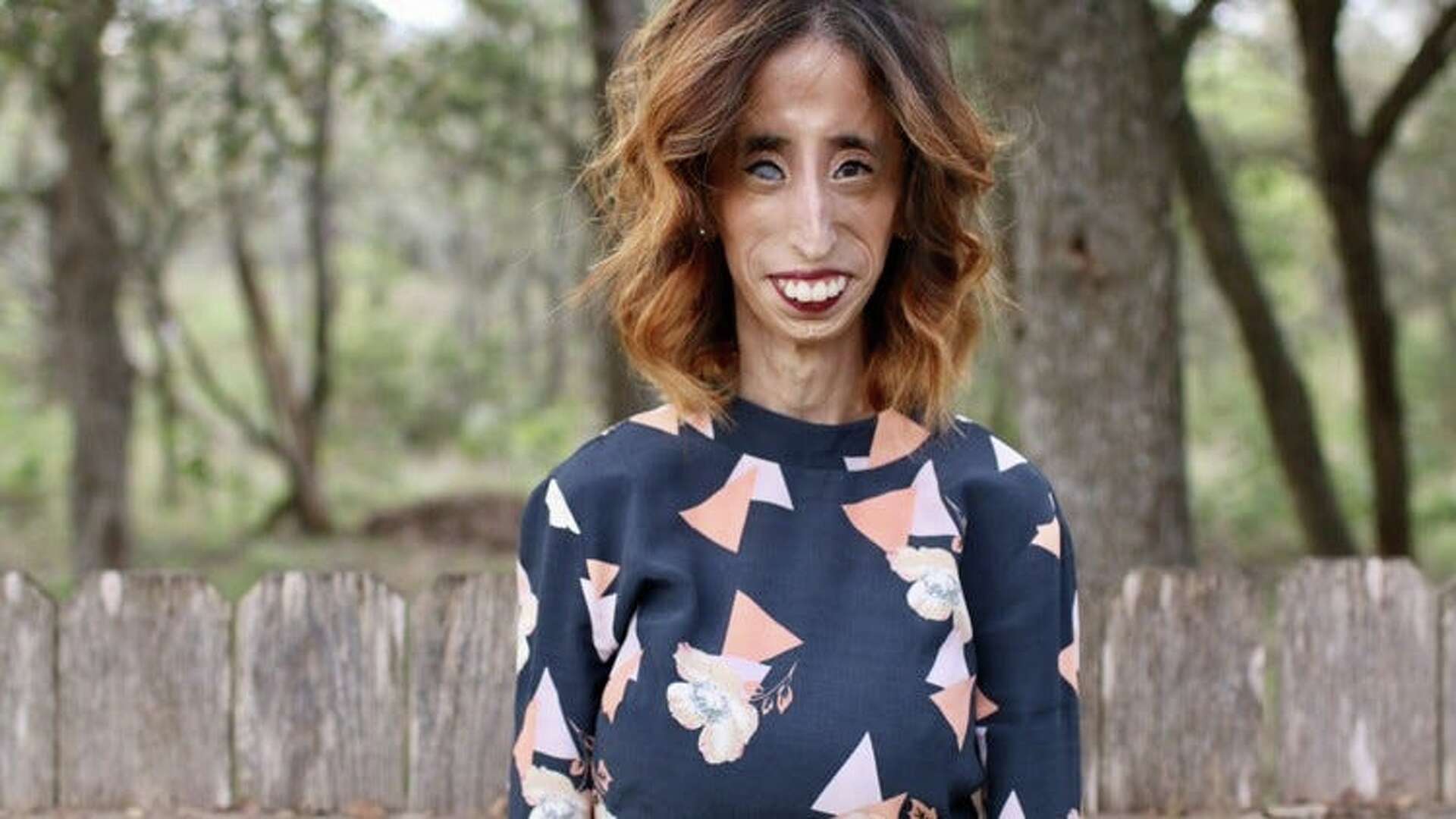 Lizzie Vel&aacute;squez found life beyond being known for looking different