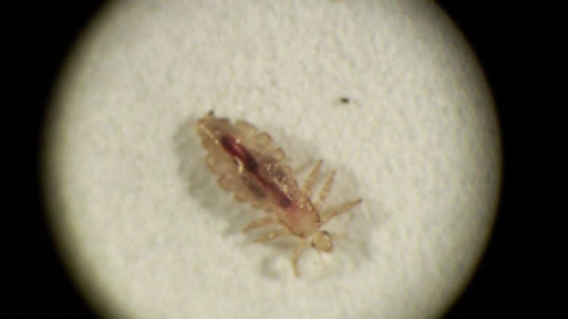 Do Lice Survive on Clothes? Uncover the Truth