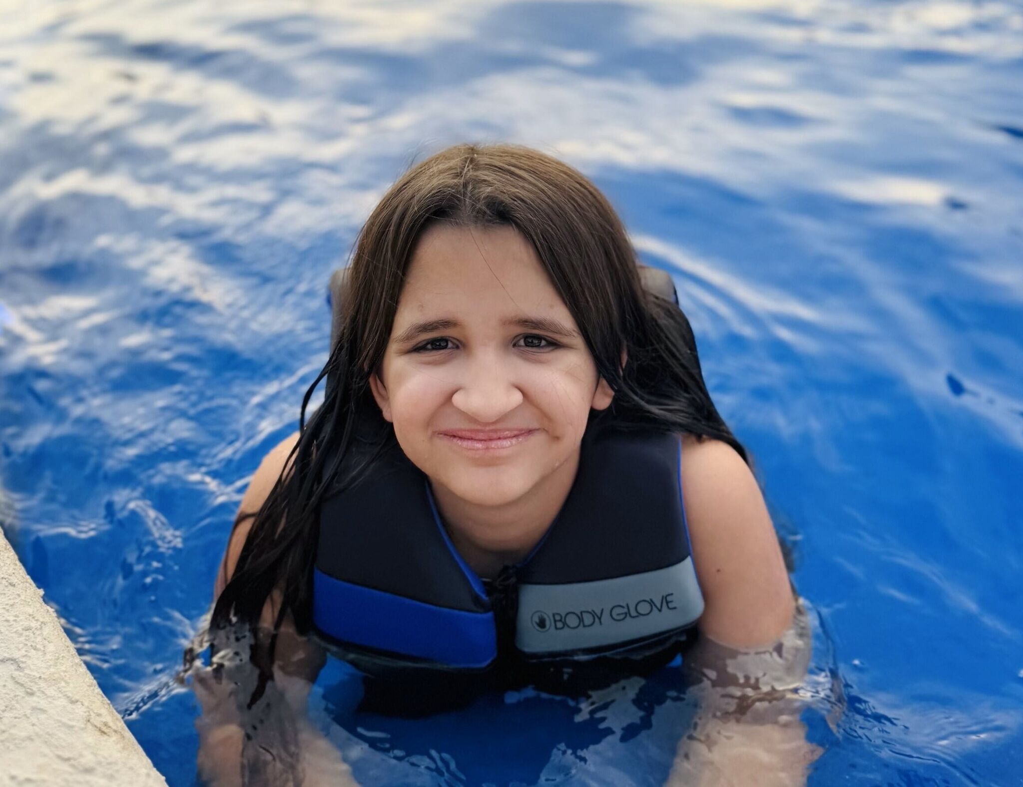 Robotic brain surgery at Texas Children’s offers chance at normal life