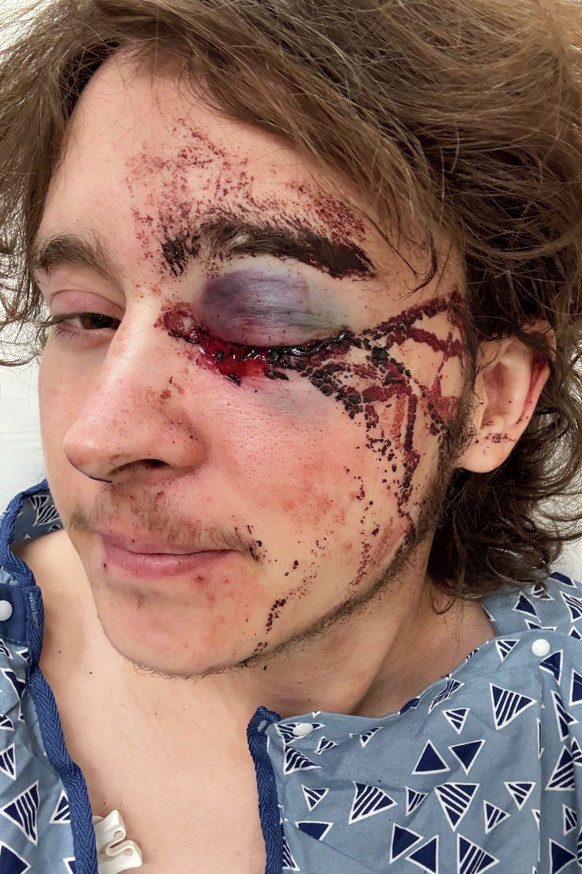 Demonstrator injured after federal agent fired projectile from close range during California protest