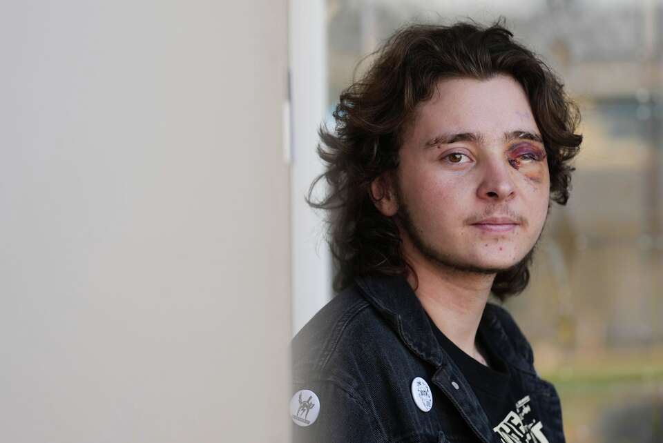 Demonstrator injured after federal agent fired projectile from close ...