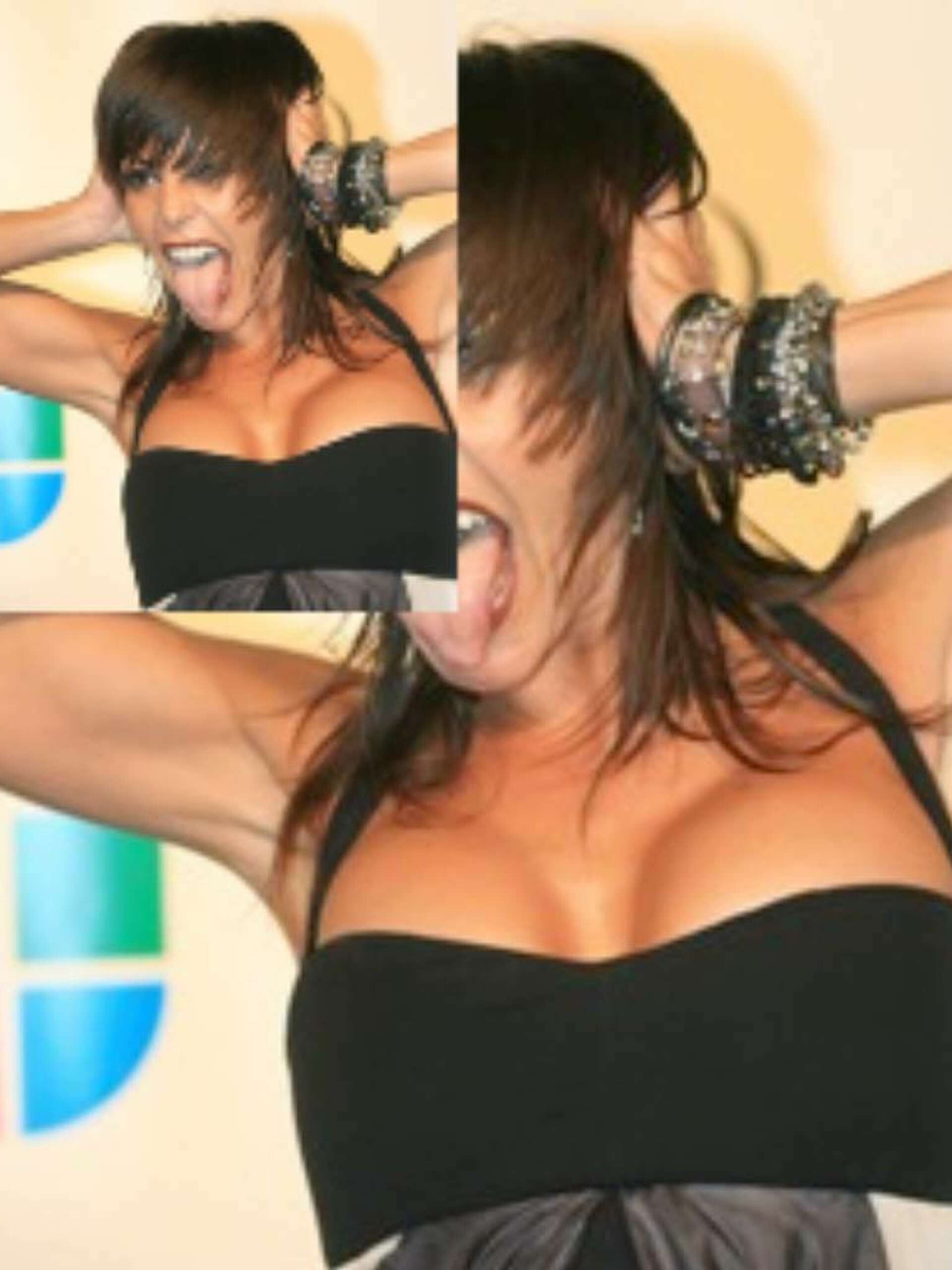 Alejandra Guzman infected by bad buttocks procedure