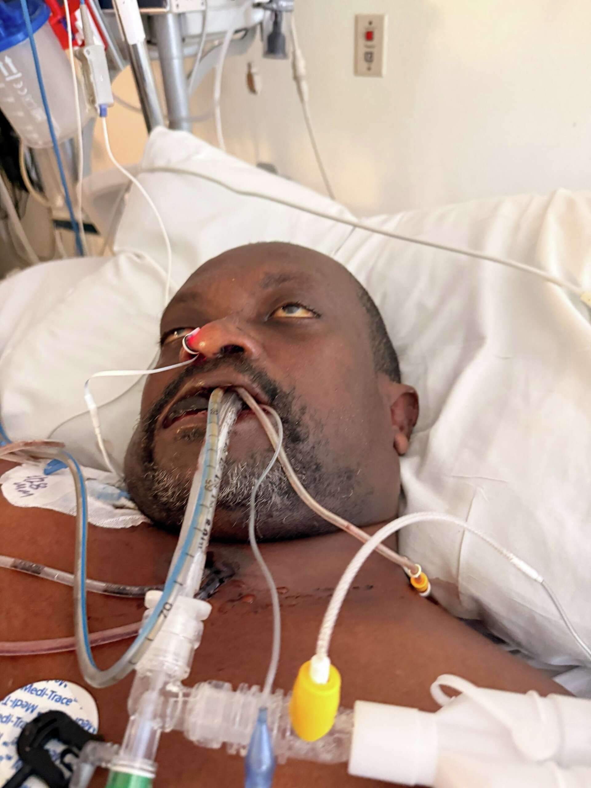 Haitian man dies in US immigration custody with untreated toothache ...
