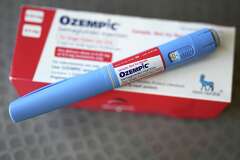 Bay Area doctor finds link between Ozempic and hair loss