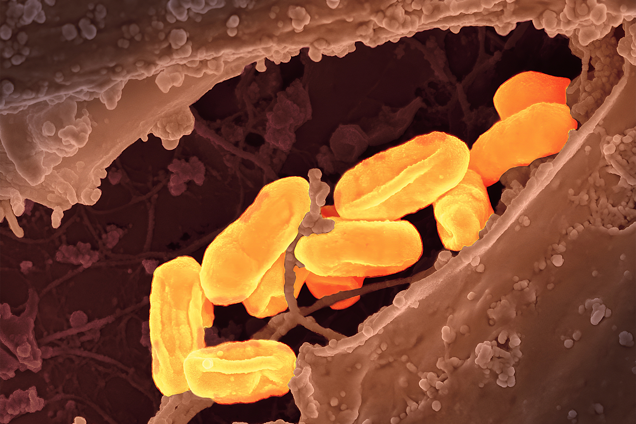 Dangerous disease 'old as the plague' hits record high in California