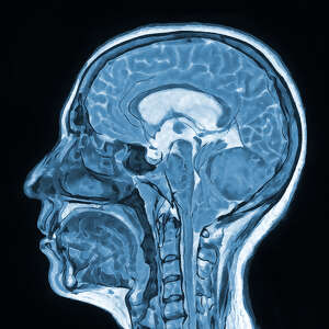 UT Dallas study finds cocaine rewires brain, fueling addiction