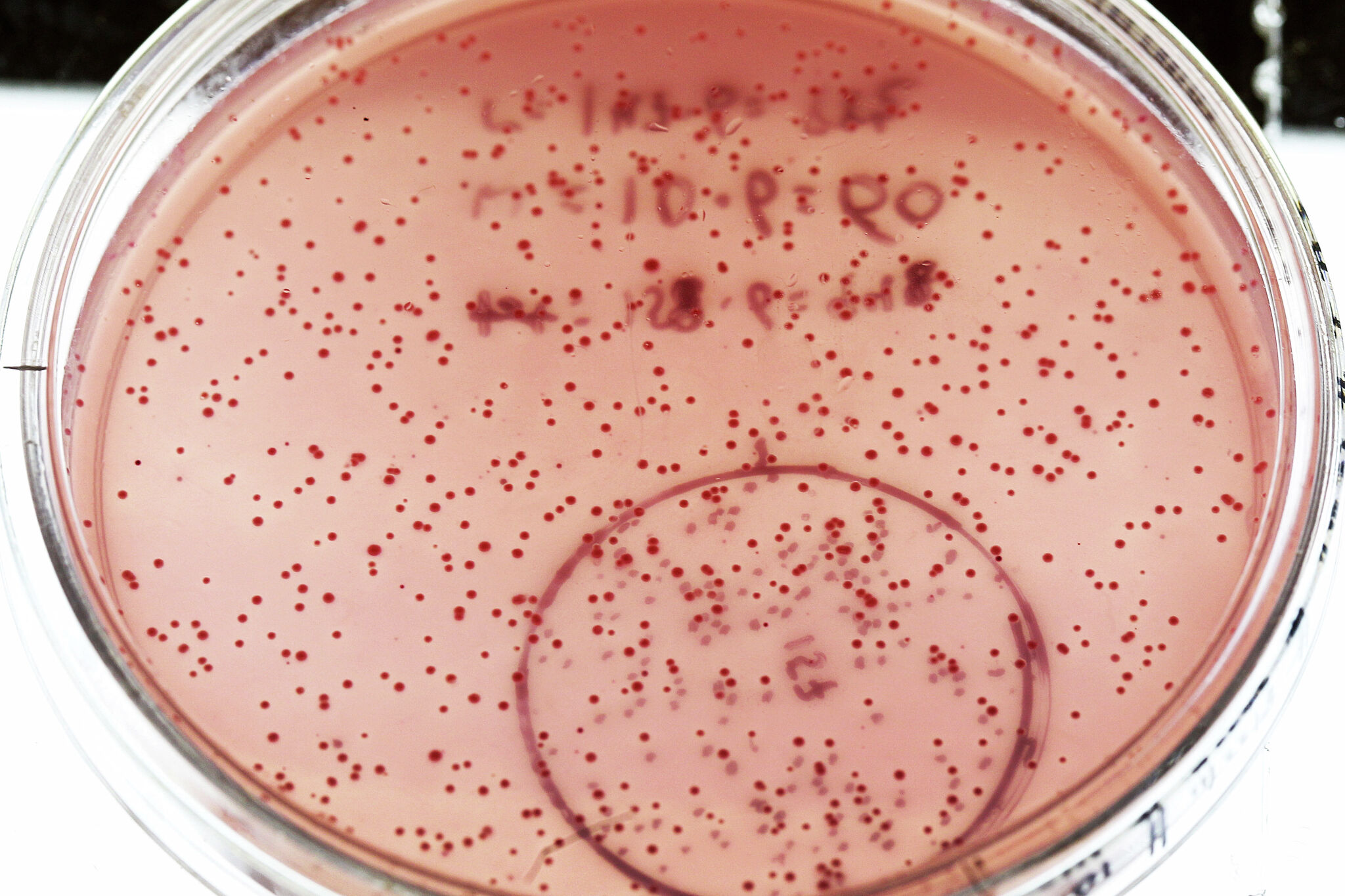 E. coli outbreak linked to California restaurant chain sickens nine people across state – San Francisco Chronicle