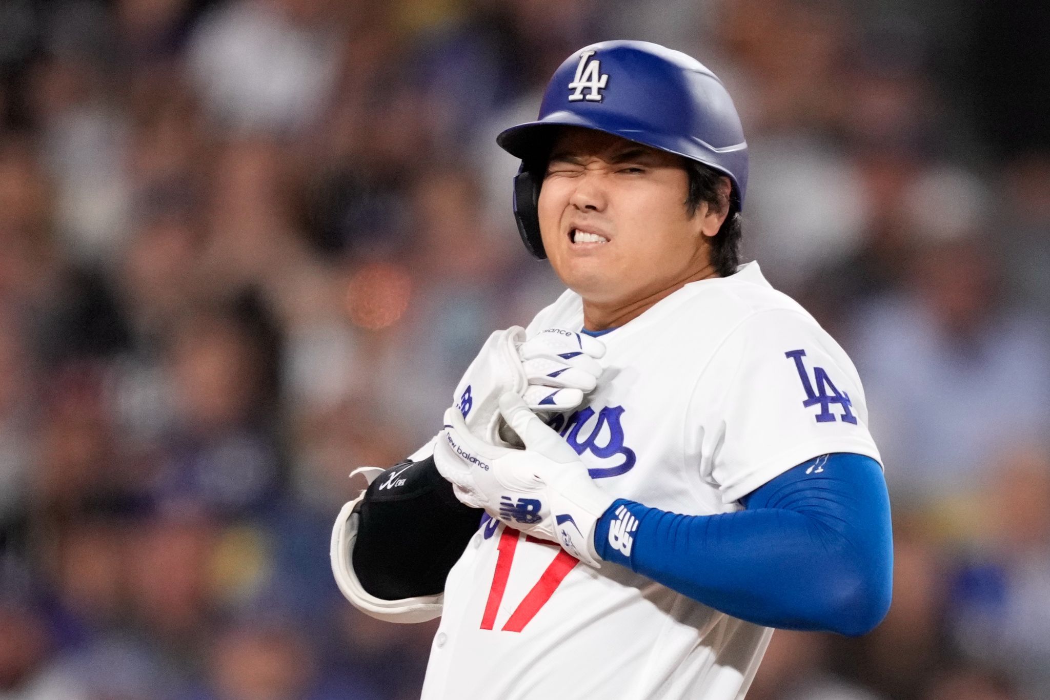 Dodgers' Shohei Ohtani still set to start after getting hit on