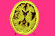 MRI of the brain of a patient affected by Alzheimer’s disease, axial cut-away view.