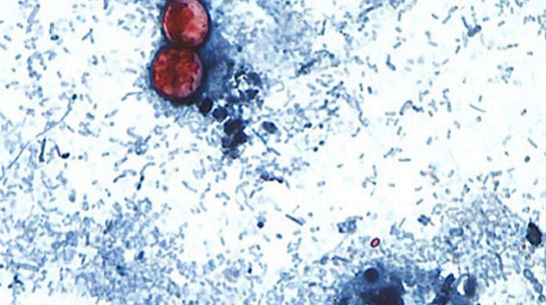 https://s.hdnux.com/photos/01/66/61/11/31134291/5/rawImage.jpg